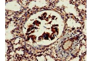 Immunohistochemistry of paraffin-embedded human lung tissue using ABIN7164755 at dilution of 1:100 (PRAS40 antibody  (AA 52-101))