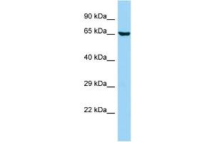 WB Suggested Anti-ANKS1B Antibody Titration: 1. (ANKS1B antibody  (C-Term))