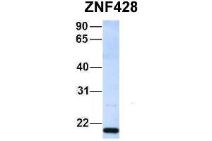 Host:  Rabbit  Target Name:  ZNF428  Sample Type:  293T  Antibody Dilution:  1. (ZNF428 antibody  (Middle Region))