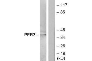 Western blot analysis of extracts from Jurkat cells, treated with insulin (0. (PER3 antibody  (N-Term))
