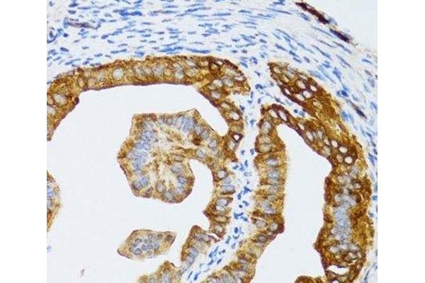CHAF1B antibody
