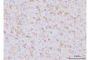 IHC analysis of RAP1GAP using anti-RAP1GAP antibody (ABIN7599729). (RAP1GAP antibody  (AA 11-661))
