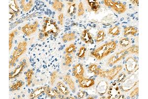 ABIN6258426 and ABIN6275705 at 1/100 staining Rat kidney tissue by IHC-P.