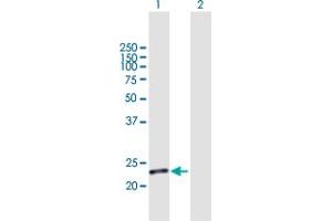 Western Blot analysis of C19orf80 expression in transfected 293T cell line by C19orf80 MaxPab polyclonal antibody. (C19ORF80 antibody  (AA 1-251))