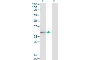 Western Blot analysis of CLIC2 expression in transfected 293T cell line by CLIC2 monoclonal antibody (M01), clone 2C1. (CLIC2 antibody  (AA 1-247))