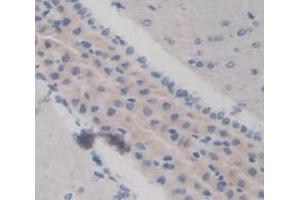 Used in DAB staining on fromalin fixed paraffin- embedded Kidney tissue (KERA antibody  (AA 21-292))