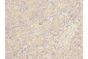 Immunohistochemistry of paraffin-embedded human tonsil tissue using ABIN7147374 at dilution of 1:100 (CEP57L1 antibody  (AA 1-167))