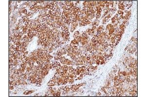 Immunohistochemistry (IHC) image for anti-Melan A (MLANA) (C-Term) antibody (ABIN5611398) (MLANA antibody  (C-Term))