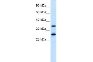 WB Suggested Anti-M96 Antibody Titration:  0.