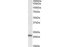 Western Blotting (WB) image for anti-IMP3, U3 Small Nucleolar Ribonucleoprotein (IMP3) (Internal Region) antibody (ABIN2464879)