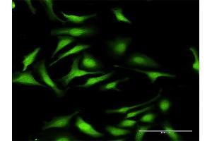 Immunofluorescence of purified MaxPab antibody to DNMT3L on HeLa cell. (DNMT3L antibody  (AA 1-386))