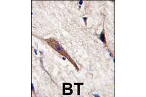 Formalin-fixed and paraffin-embedded human brain tissue reacted with PAK7 polyclonal antibody  , which was peroxidase-conjugated to the secondary antibody, followed by DAB staining. (PAK7 antibody  (AA 183-198))