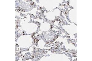 Immunohistochemical staining of human lung with ZNF77 polyclonal antibody  shows strong cytoplasmic positivity in subsets of alveolar cells.