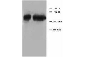Image no. 2 for anti-Tumor Protein P73 (TP73) (C-Term) antibody (ABIN1492940) (Tumor Protein p73 antibody  (C-Term))