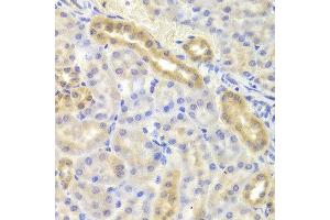 Immunohistochemistry of paraffin-embedded Mouse kidney using DIAPH1 antibody at dilution of 1:100 (x40 lens). (DIAPH1 antibody)