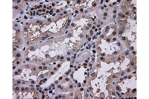 Immunohistochemical staining of paraffin-embedded thyroid tissue using anti-L1CAMmouse monoclonal antibody. (L1CAM antibody)