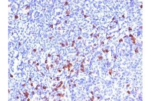 Formalin-fixed, paraffin-embedded human Tonsil stained with IgG Monoclonal Antibody (SPM556) (IGHG antibody)