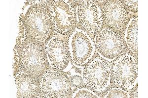 ABIN7094452 and ABIN7098500 at 1/100 staining Rat testis tissue by IHC-P. (MDC1 antibody  (C-Term))