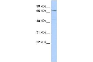 WB Suggested Anti-CLPB Antibody Titration: 0. (CLPB antibody  (Middle Region))