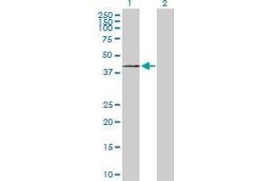 Western Blot analysis of ST3GAL1 expression in transfected 293T cell line by ST3GAL1 MaxPab polyclonal antibody. (ST3GAL1 antibody  (AA 1-340))