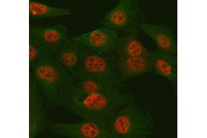 IF analysis of TULP3 using anti-TULP3 antibody (ABIN7602191) and anti-Tubulin Alpha antibody (ABIN7600339). (TULP3 antibody  (AA 62-362))