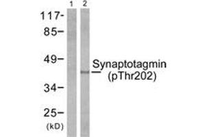 Western blot analysis of extracts from 293 cells treated with Forskolin 40nM 30', using Synaptotagmin (Phospho-Thr202) Antibody. (Synaptotagmin antibody  (pThr202))
