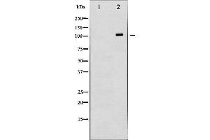 Western blot analysis of HDAC6 expression in HepG2 whole cell lysates,The lane on the left is treated with the antigen-specific peptide. (HDAC6 antibody  (N-Term))