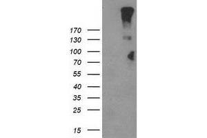 HEK293T cells were transfected with the pCMV6-ENTRY control (Left lane) or pCMV6-ENTRY LGR5 (Right lane) cDNA for 48 hrs and lysed. (LGR5 antibody  (AA 250-550))