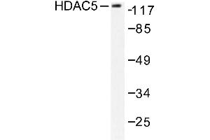 Image no. 2 for anti-Histone Deacetylase 5 (HDAC5) antibody (ABIN265457) (HDAC5 antibody)