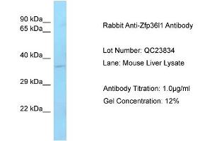 Host: Rabbit Target Name: Zfp36I1 Sample Type: Mouse Liver Antibody Dilution: 1. (ZFP36L1 antibody  (C-Term))