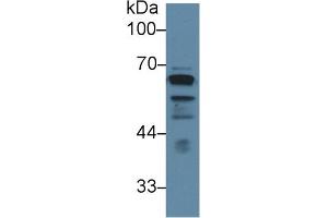 Detection of LCAT in Human PC3 cell lysate using Polyclonal Antibody to Lecithin Cholesterol Acyltransferase (LCAT) (LCAT antibody  (AA 290-432))