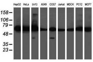 Image no. 4 for anti-Diphthamide Biosynthesis Protein 2 (DPH2) antibody (ABIN1497893)