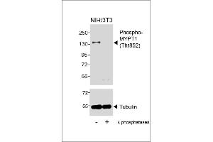 Western blot analysis of lysates from NIH/3T3 cell line, untreated or treated with λ phosphatases, 30 min, using Phospho-MYPT1 (Thr852) Antibody (upper) or Tubulin (lower). (PPP1R12A antibody  (pThr852))