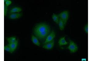 Immunofluorescence staining of HepG2 cells with ABIN7144476 at 1:50, counter-stained with DAPI. (AIFM2 antibody  (AA 110-373))
