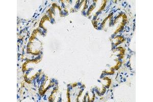 Immunohistochemistry of paraffin-embedded Rat lung using AK1 Polyclonal Antibody at dilution of 1:100 (40x lens). (Adenylate Kinase 1 antibody)