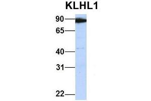 Host:  Rabbit  Target Name:  KLHL1  Sample Type:  Human 721_B  Antibody Dilution:  1. (KLHL1 antibody  (Middle Region))