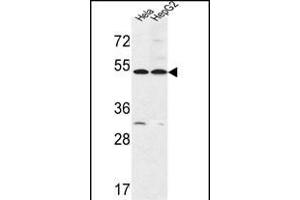 FERMT1 Antibody (Center) (ABIN652858 and ABIN2842558) western blot analysis in Hela,HepG2 cell line lysates (35 μg/lane). (FERMT1 antibody  (AA 268-297))