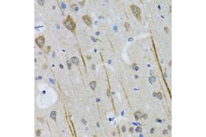 Immunohistochemistry of paraffin-embedded mouse brain using HTR3A antibody. (Serotonin Receptor 3A antibody  (AA 24-241))