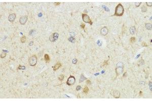 Immunohistochemistry (Paraffin-embedded Sections) (IHC (p)) image for anti-HECT Domain and Ankyrin Repeat Containing, E3 Ubiquitin Protein Ligase 1 (HACE1) antibody (ABIN7264832)