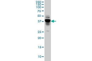 NDRG4 monoclonal antibody (M01), clone 2G3. (NDRG4 antibody  (AA 1-339))