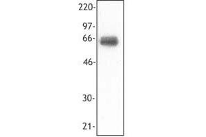 Image no. 1 for anti-Triggering Receptor Expressed On Myeloid Cells 1 (TREM1) antibody (ABIN205339) (TREM1 antibody)