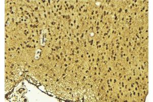 ABIN6275645 at 1/100 staining Mouse brain tissue by IHC-P. (TSEN54 antibody  (Internal Region))