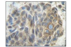 Image no. 1 for anti-Placenta Growth Factor (PGF) antibody (ABIN181639) (PLGF antibody)
