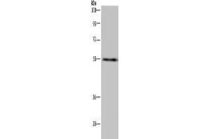 Western Blotting (WB) image for anti-IMP (Inosine 5'-Monophosphate) Dehydrogenase 2 (IMPDH2) antibody (ABIN2423659) (IMPDH2 antibody)