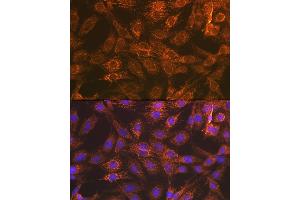 Immunofluorescence analysis of C6 cells using Smac/Diablo Rabbit mAb (ABIN7270177) at dilution of 1:100 (40x lens).