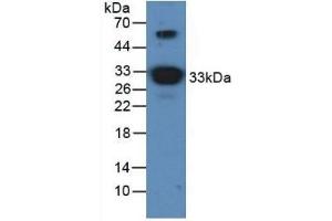 Detection of APOA1 in Mouse Brain Tissue using Polyclonal Antibody to Apolipoprotein A1 (APOA1) (APOA1 antibody)