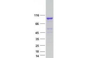 Western Blotting (WB) image for TBC1 Domain Family, Member 5 (TBC1D5) (Transcript Variant 2) protein (Myc-DYKDDDDK Tag) (ABIN2733253)