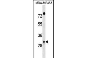 DP1 Antibody (C-term) 17383b western blot analysis in MDA-M cell line lysates (35 μg/lane). (DAPP1 antibody  (C-Term))