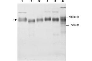 Western blot analysis of Scarb2 in various samples using Scarb2 polyclonal antibody . (SCARB2 antibody)