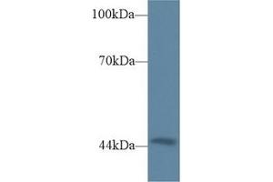 Detection of TRDN in Mouse Heart lysate using Polyclonal Antibody to Triadin (TRDN) (Triadin antibody  (AA 486-687))